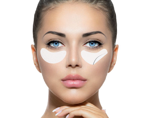 Eyes contour patches