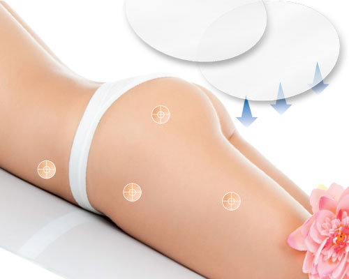 Patch anti cellulite